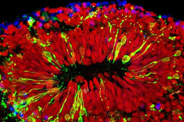 科學(xué)家攻克Zika病毒 高中生攜3D打印來幫忙

Zika病毒,3D打印醫(yī)療行業(yè),3D打印材料價格,3D打印技術(shù),3D打印材料,3D打印成本,3D打印價格