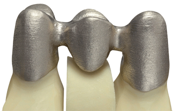 德國(guó)率先引入3D打印牙齒技術(shù) 全程體驗(yàn)“無(wú)痛”種牙-e鍵打印|3D打印服務(wù)
3d打印牙齒,3D打印種牙,無(wú)痛種牙,3D打印平臺(tái),3D打印服務(wù),南京哪里有3D打印,南京3D打印廠家,南京3D打印服務(wù)