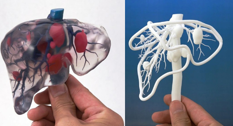 簡述現階段醫(yī)用3D打印設備和打印材料的相關進展_e鍵3D打印服務