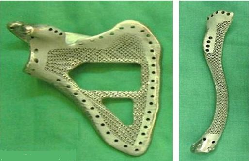 3d打印應用領域之醫療應用_e鍵打印服務公司