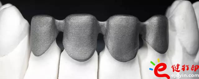 醫(yī)療輔助器械的變革之路 3d打印義齒(假牙)前景無(wú)限 勢(shì)在必行_醫(yī)療設(shè)備器械3d模型打印平臺(tái) 醫(yī)療輔助器械的變革之路 3d打印義齒(假牙)前景無(wú)限 勢(shì)在必行_醫(yī)療設(shè)備器械3d模型打印平臺(tái)