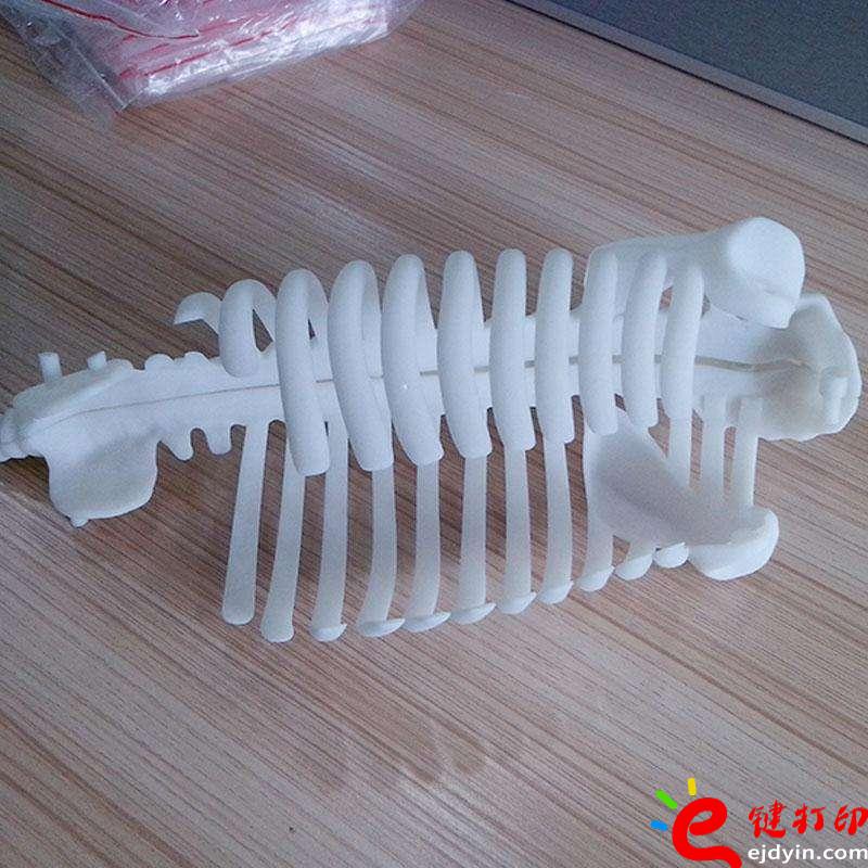 醫療3D打印骨骼模型、3d打印定制手板,3d打印加工手板,3d打印手板模型,3d打印模型,深圳3d打印手板,3d打印手板工廠,工業級3d打印手板公司