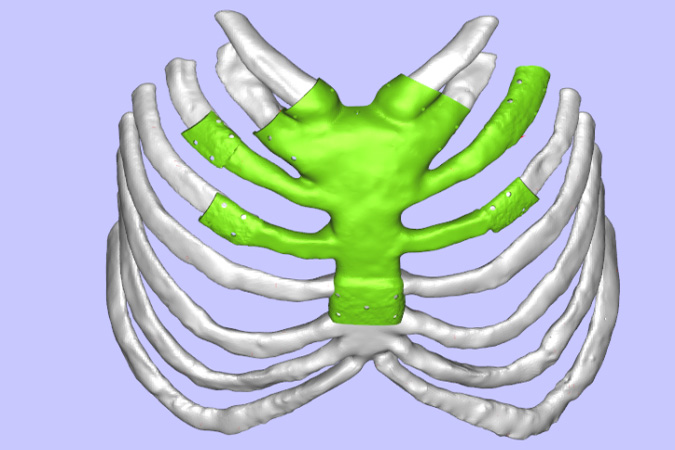 醫療行業應用3d打印技術的優點與缺點